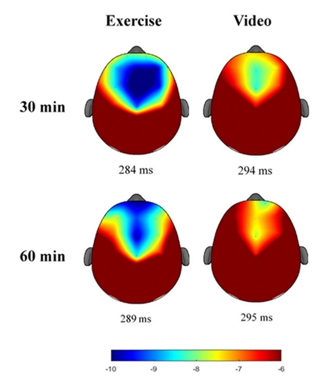 Figure 1: Topographical distribution of ERP-N2 amplitude