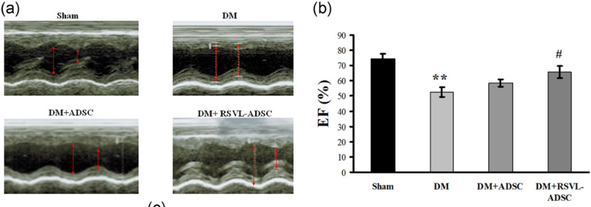 圖1：糖尿病大鼠心臟功能檢測結果。(a)心臟超音波圖；(b)心臟血液射出率。(Sham, 正常鼠；DM, 糖尿病大鼠；DM+ADSC, 糖尿病大鼠接受一般幹細胞治療；DM+RSVL-ADSC, 糖尿病大鼠接受白藜蘆醇強化幹細胞治療)